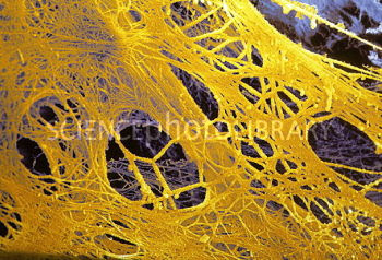 P2600051-Coloured_SEM_of_blood-clotting_fibrin_strands-SPL