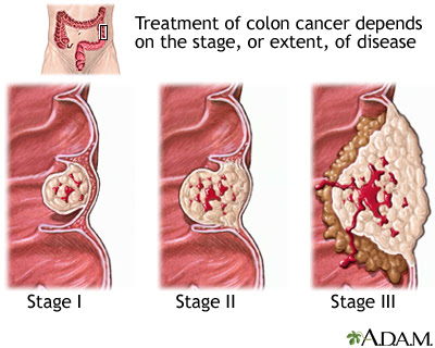colon hie colorectal