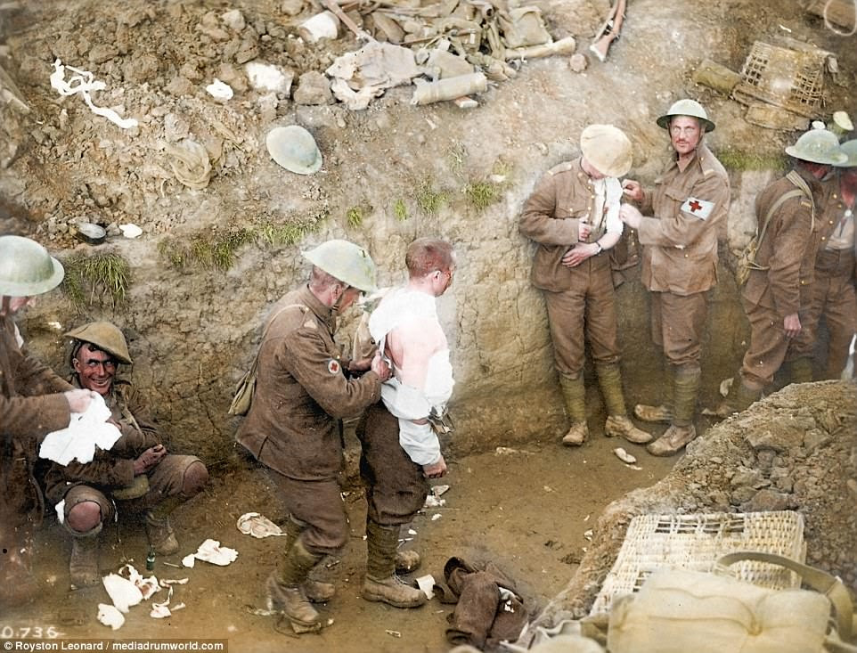 A solider who appears to be suffering with shell shock is pictured on the left as his comrades provide medical aid to others. By the end of World War One the British Army had dealt with 80,000 cases of shell shock. In the early years of the war it was believed to be the result of a physical injury to the nerves. Cases of 'shell shock' were therefore considered as either a physical or psychological injury, or simply as a lack of moral fibre.  It is now considered to be a type of posttraumtic stress syndrome, a reaction to the intensity of the bombardment and fighting