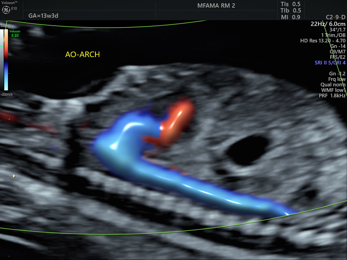 Anatomy Ultrasound Near Me Anatomy Diagram Book