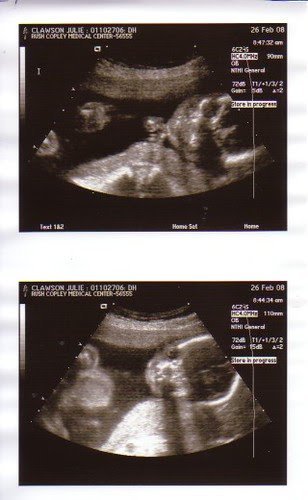Clawson Baby Blog: Ultrasound Pictures