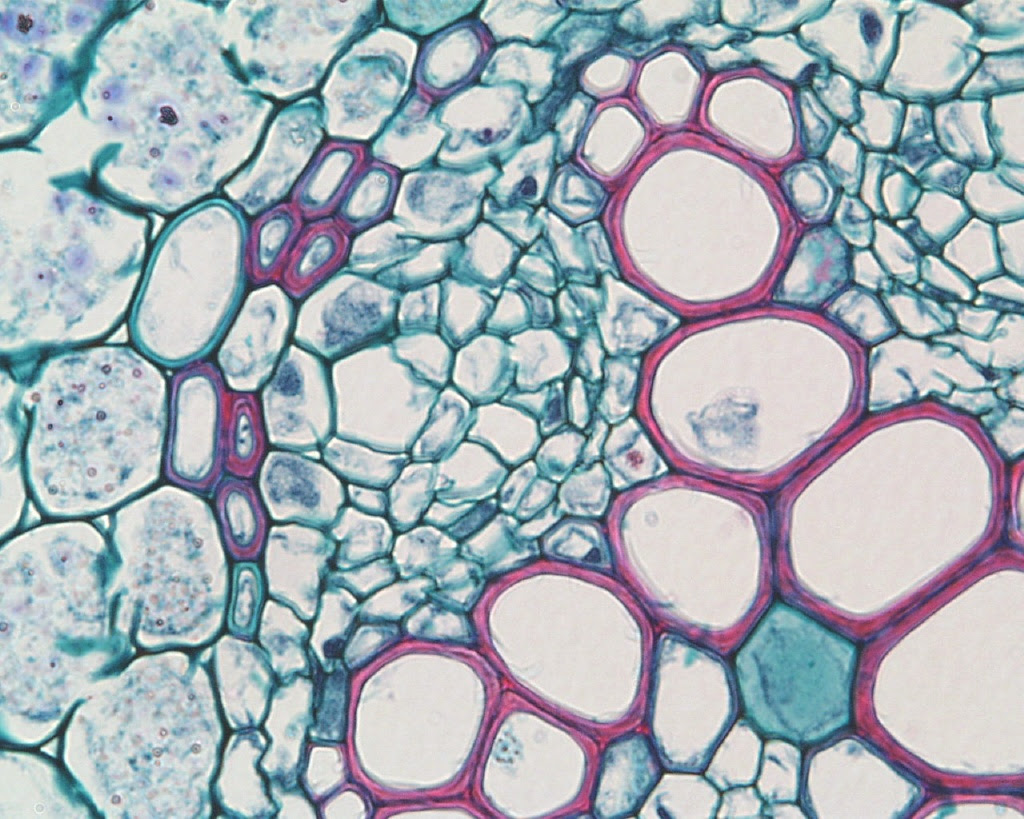 Механическая ткань растений сосуды. Ксилема микроскоп. Флоэма микрофотография. Ксилема и флоэма микроскоп. Флоэма в микроскоп.