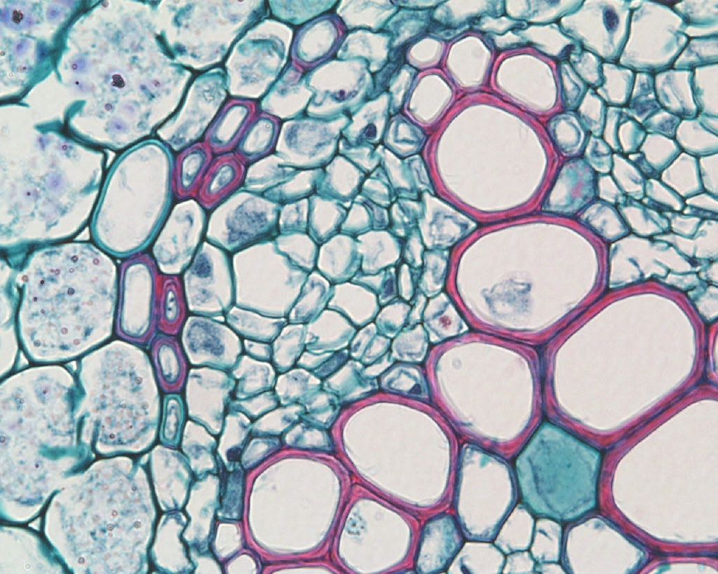Клетки ксилемы живые. Ксилема микроскоп. Флоэма микрофотография. Ксилема и флоэма микроскоп. Флоэма в микроскоп.