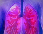 Se consigue producir organoides pulmonares