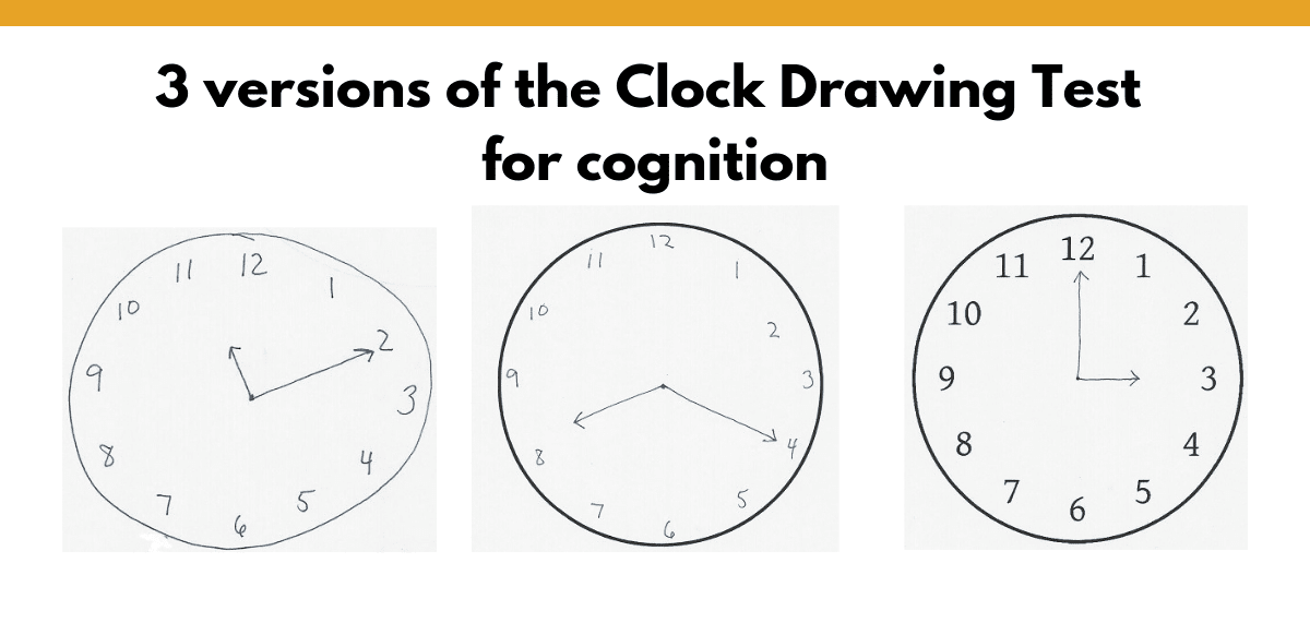 Clock Drawing Test Results / Clock Drawing Test Youtube