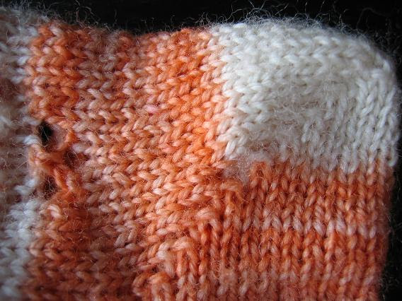 sicleheel