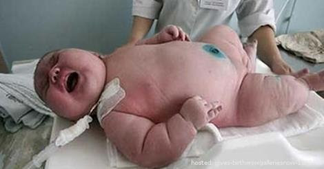 最も好ましい 赤ちゃん 太ってる 将来 赤ちゃん 太ってる 将来 Imagejoshbkh