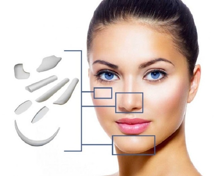 Với nâng mũi cấu trúc, bác sĩ sẽ kết hợp với sụn sinh học và sụn nhân tạo để điều chỉnh dáng mũi