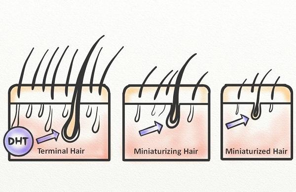نقش کلاژن در درمان ریزش مو