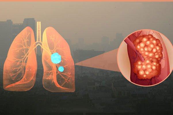 80% các bệnh về đường hô hấp đều do virus,  vi khuẩn và bụi bẩn trong nhà gây ra​