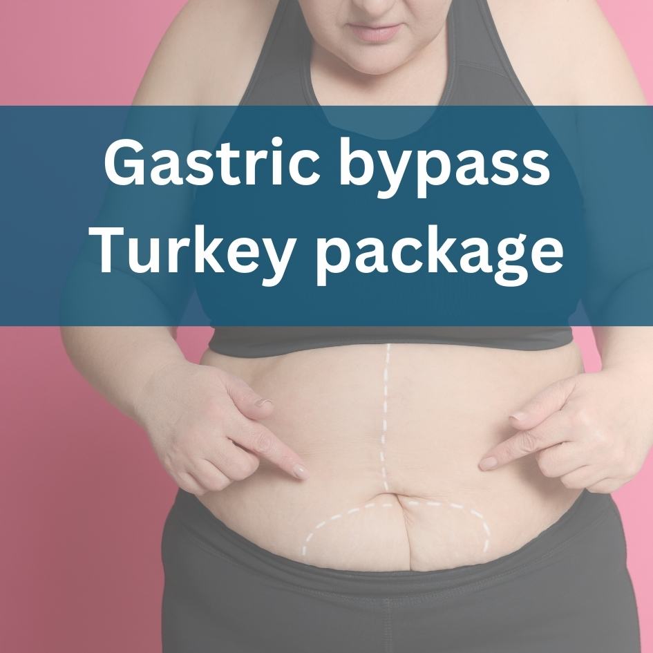 gastric bypass Turkey package