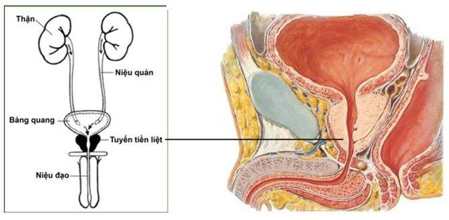 ung thư tuyến tiền liệt di căn,ung thư tuyến tiền liệt di căn xương,ung thư tuyến tiền liệt di căn hạch,ung thư tuyến tiền liệt di căn phổi