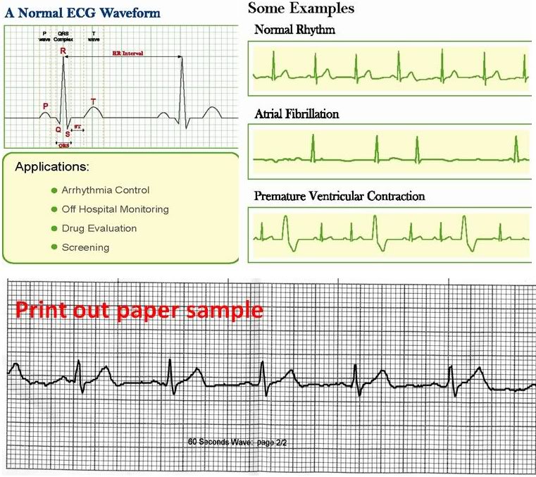 Cms50d2 Pulse Oximeter User Manual Filetype Pdf