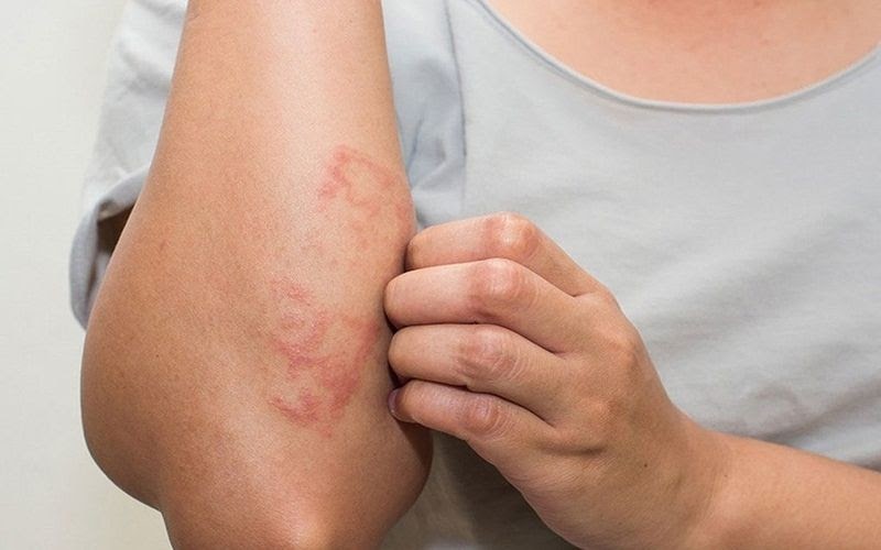 Gỗ trầm có tính chất chống dị ứng cao
