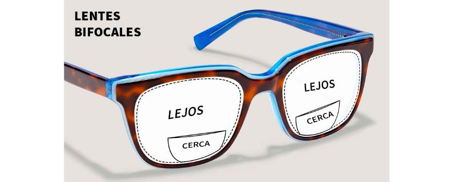 Graduaci n de lentes en M rida Dr. Carlos Pablo Gonz lez Carillo