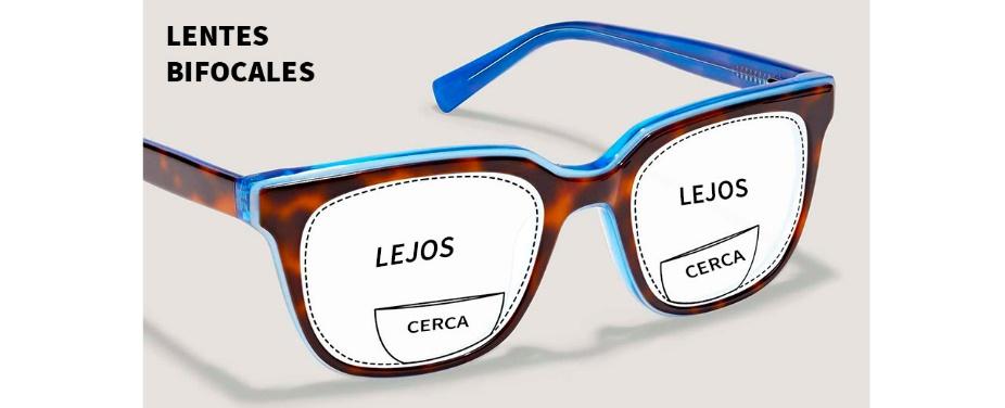 de lentes - Dr. Carlos Pablo González Carillo