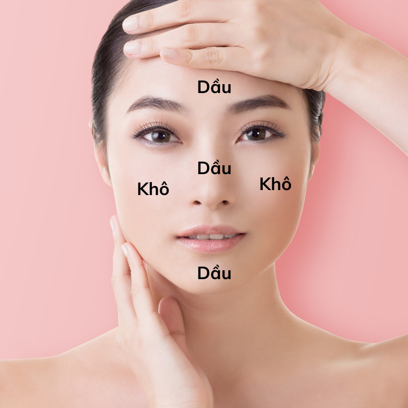 Vùng chữ T là gì? 10 mẹo kiềm dầu vùng chữ T tại nhà hiệu quả
