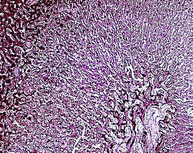 Higher magnification of border between trophoblastic giant cells (above) and trophospongium (below).