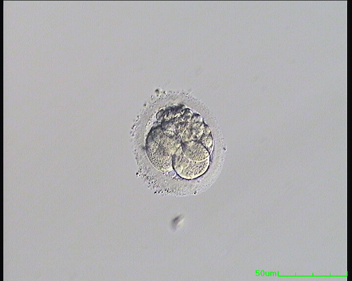 Embriyo Değerlendirmesi (Embriyo Gradeleme) Nasıl Yapılır? | Gop Tüp Bebek  Merkezi