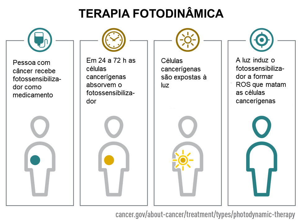 Imagem esquemática de como funciona a terapia fotodinâmica aplicada ao tratamento de câncer. 