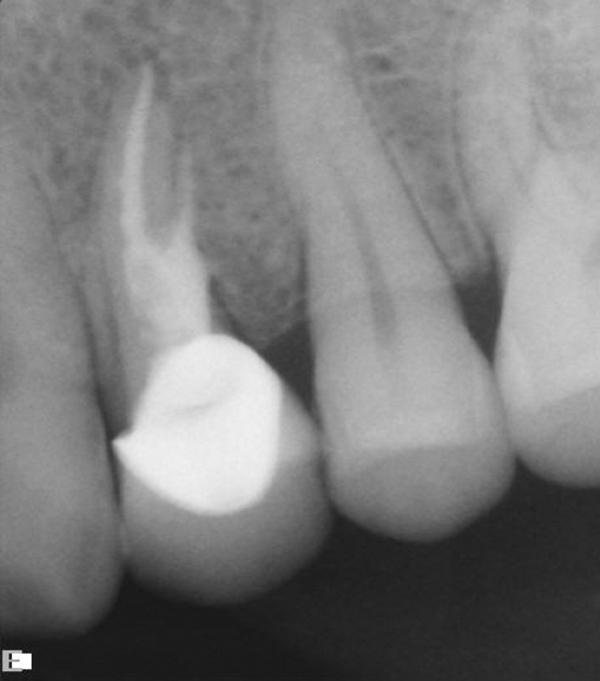 Close-up of a foot

Description automatically generated with medium confidence