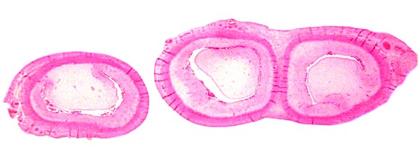Cross sections through the fetal uterus of a common waterbuck