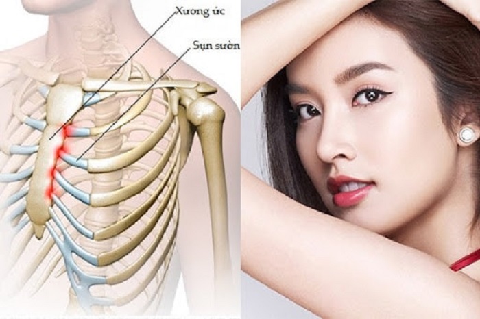 Nâng mũi sụn sườn giúp mũi đẹp và thanh tú hơn