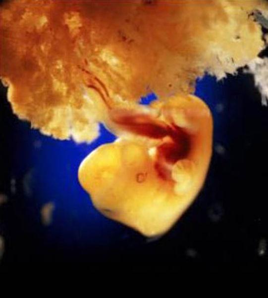 embrion_placenta.jpg