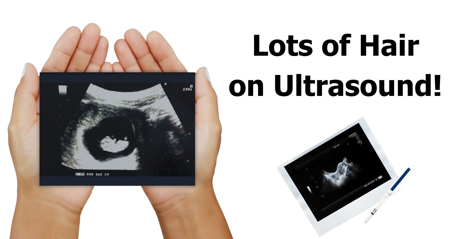 why do you pass blood clots after d&c