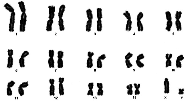 Karyotype of male steenbok
