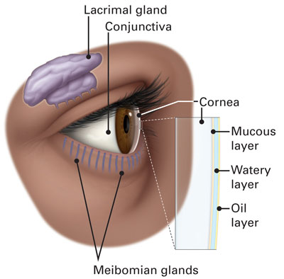 Dry eye diagram