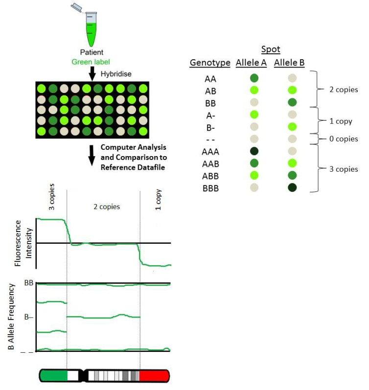 Single nucleotide polymorphism arrays for chromosomal microarray of the product of conception