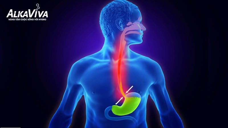 NHỮNG THỰC PHẨM MANG TÍNH KIỀM VÀ AXIT HƯỞNG THẾ NÀO ĐẾN SỨC KHỎE CỦA BẠN?