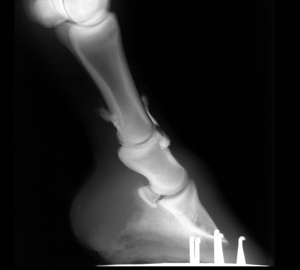 Because the palmar pouch of the PIP joint extends proximally for several centimeters this joint is fairly easily accessed using the palmar/plantar approach