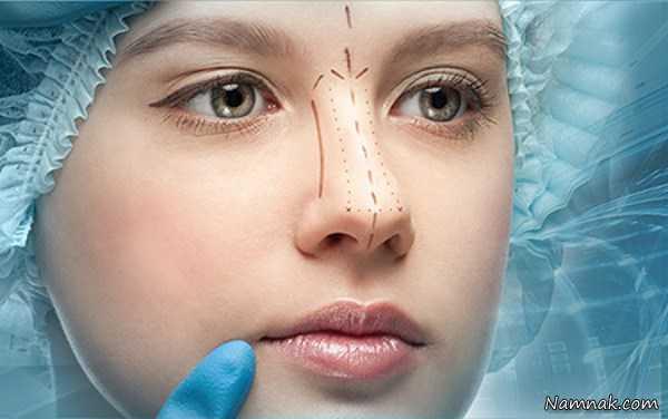 جراحی پلاستیک بینی
