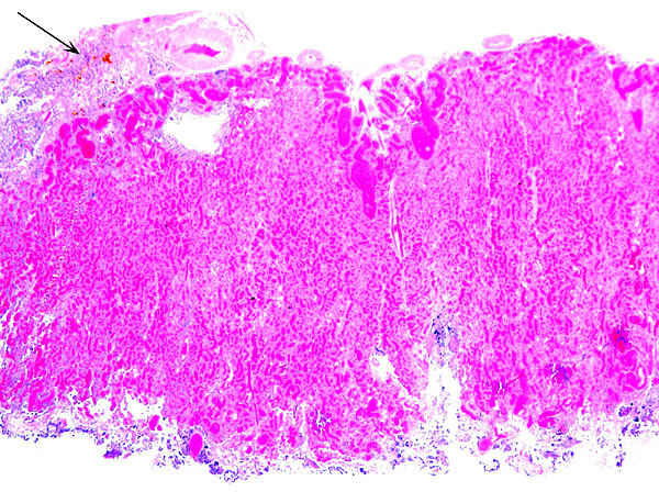 Edge of placenta with small amount of yellow pigment shown at arrow