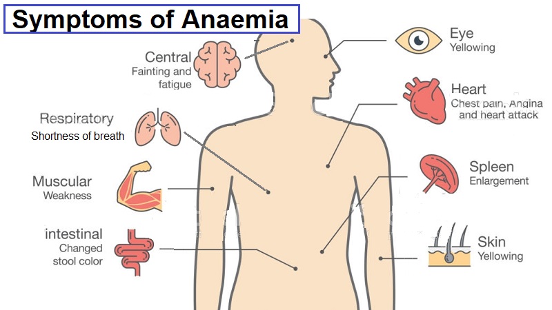 Symptoms of Anaemia