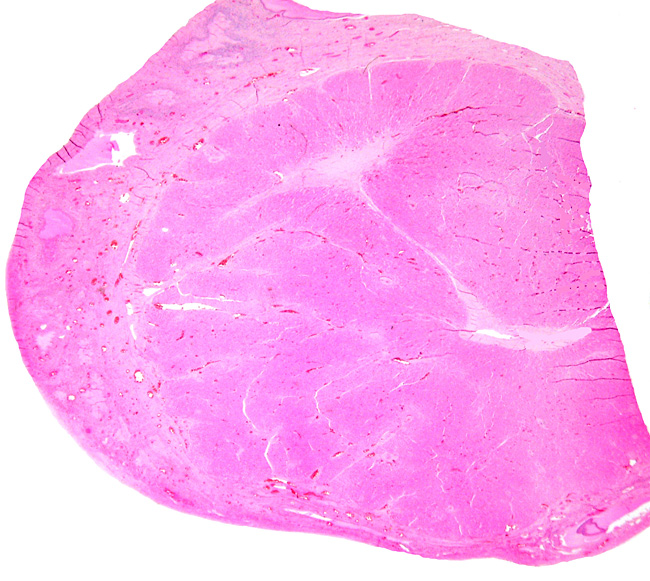 Large corpus luteum from northern fur seal
