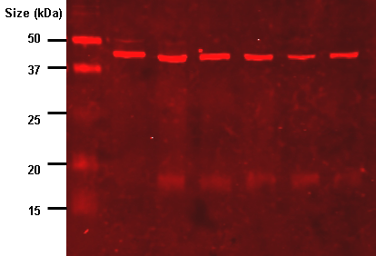 the results of protein electrophoresis with the protein ladders in the first column of the immunoblot