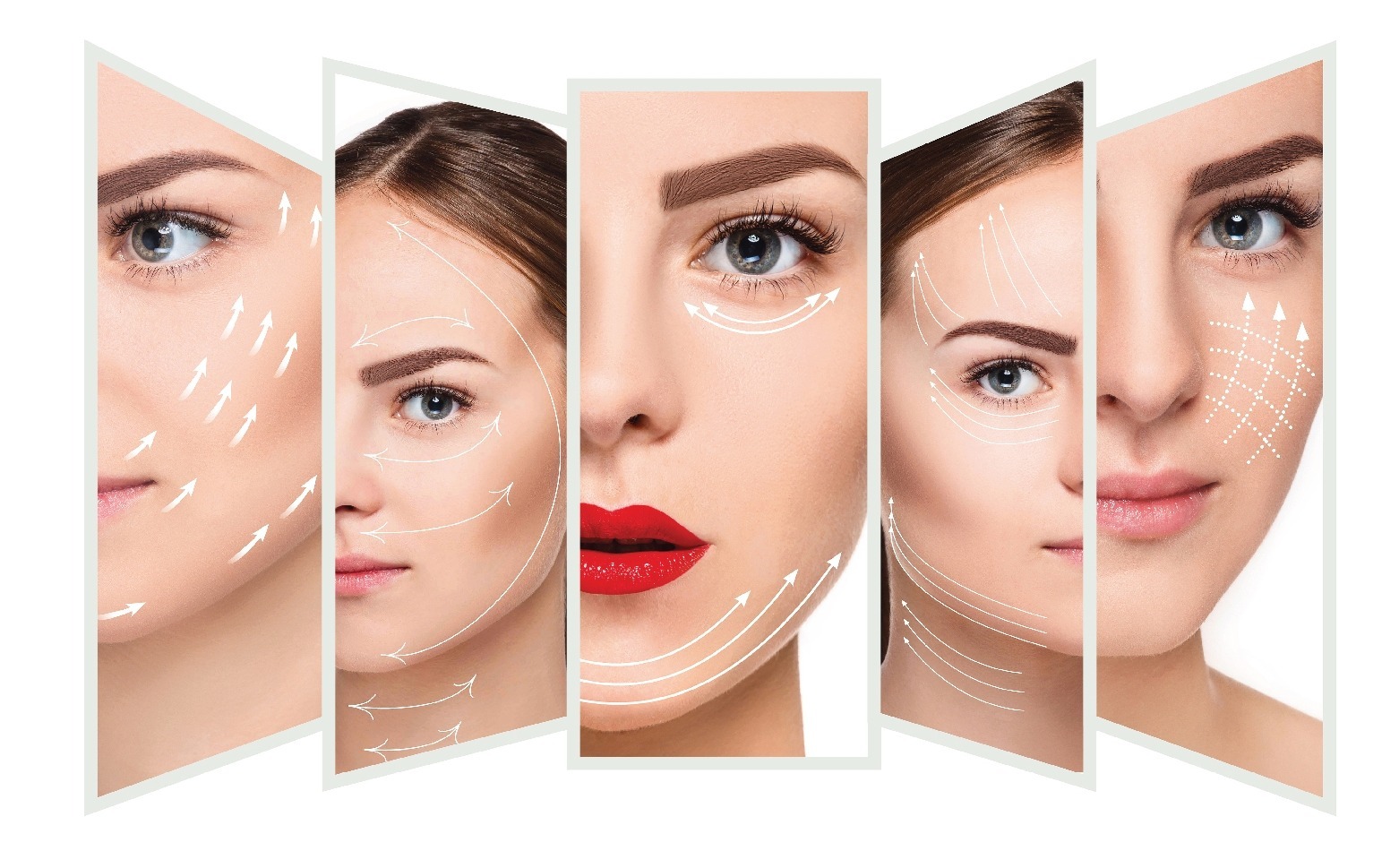 Căng chỉ collagen ra đời là phương pháp tối ưu giúp chị em giải quyết các vấn đề về lão hóa.