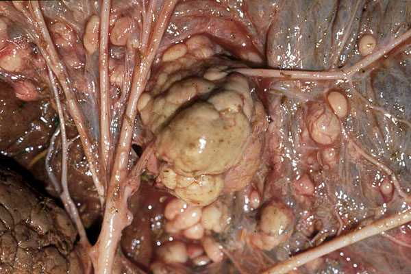 Teratoma in fetal surface of horse placenta