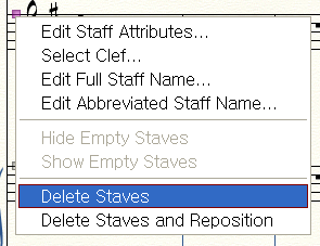 Staff - Delete Staves.png