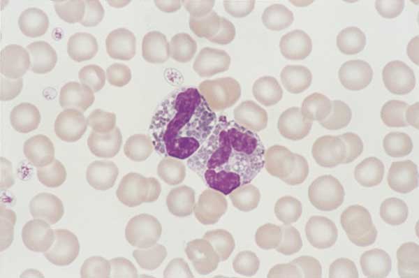 Canine eosinophils. Granules in canine eosinophils are round and can vary in size and number. Granules are numerous, round, and small.