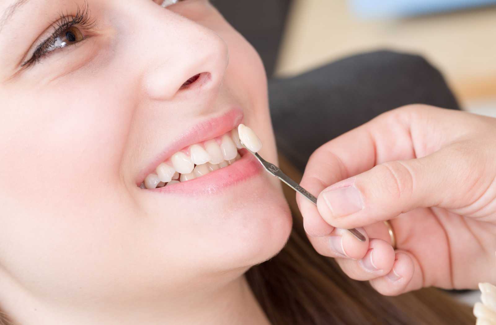 woman smiling as dentist holds up a porcelain veneer to check size and shade