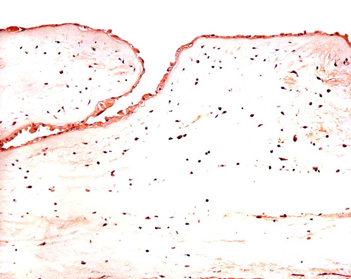 This is the surface of the chorion with allantoic epithelium