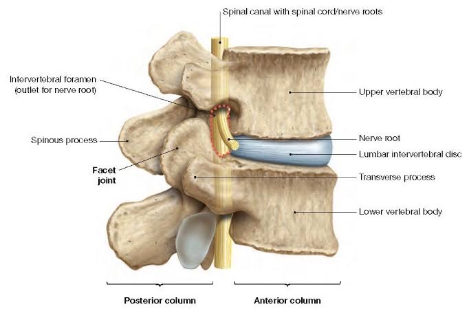 Lumbar-L4-L5-disc-herniation