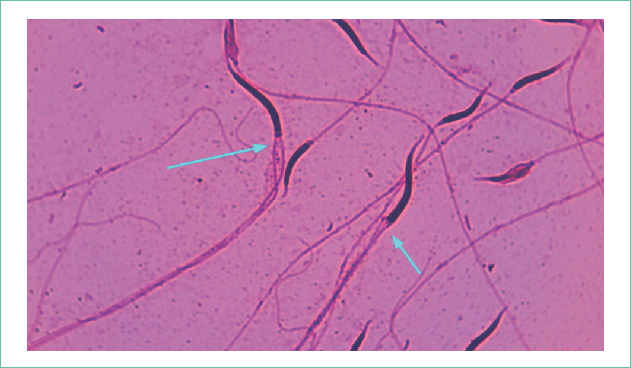 Espermatozoides de C. molossus oaxacus teñidos con fuccina básica a 40X. Las flechas azules señalan defectos en la fosa de implantación.