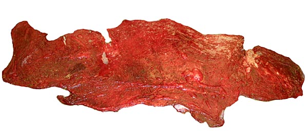 Maternal surface of second Bactrian camel