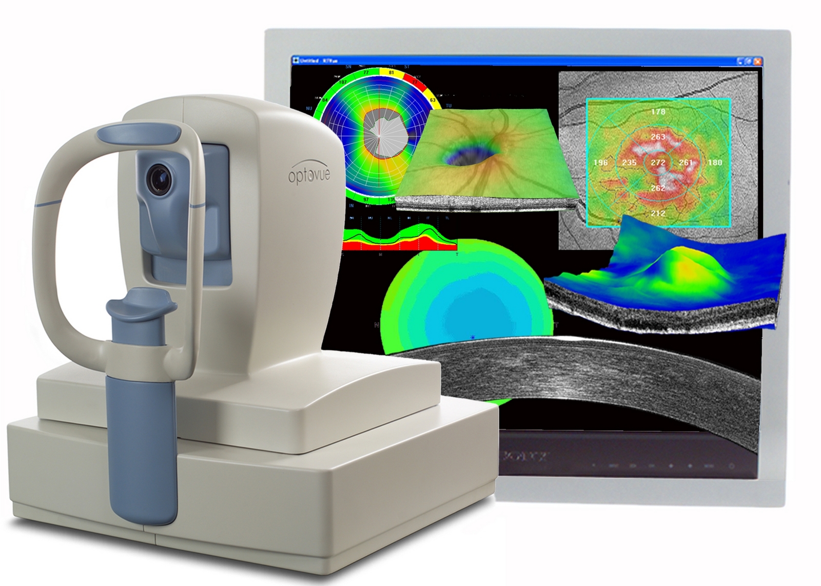 Ocular Coherence Tomography (OCT) Midwest Eye Associates Advanced