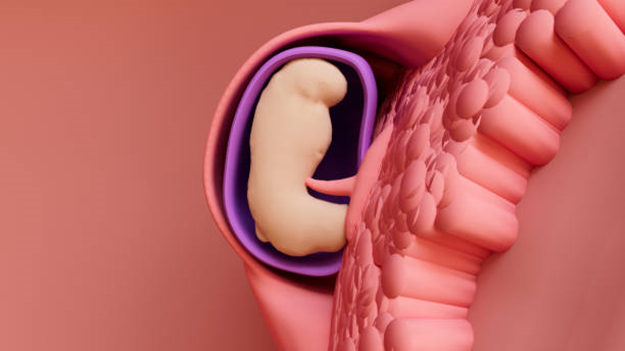 Схематичный пример имплантации эмбриона